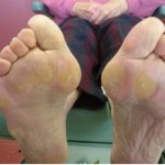 Aged Care Feet Bendigo